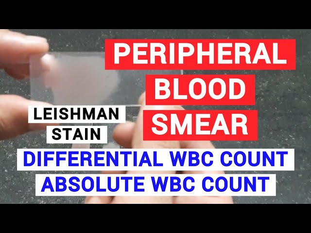 PERIPHERAL BLOOD SMEAR | HAEMATOLOGY LAB | PHYSIOLOGY PRACTICALS
