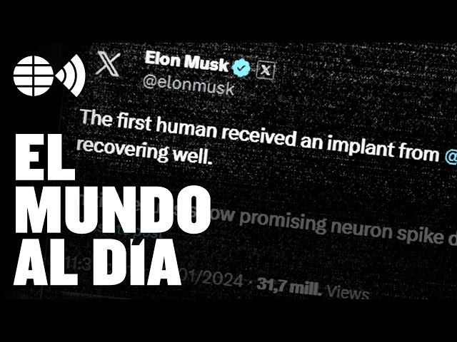 Para qué sirve el chip cerebral de Elon Musk: “El objetivo es tratar enfermedades, por ahora…”