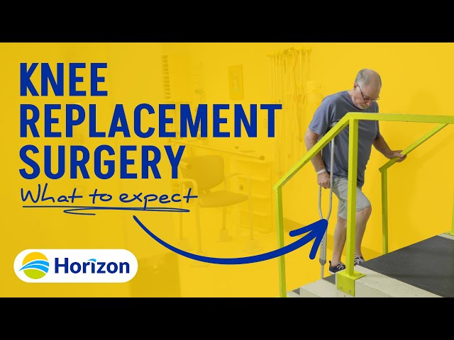 Knee Replacement Surgery - What you need to know before, during and after