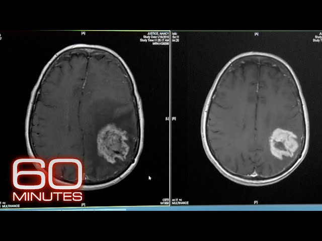 Killing cancer with a breakthrough therapy | 60 Minutes Full Episodes