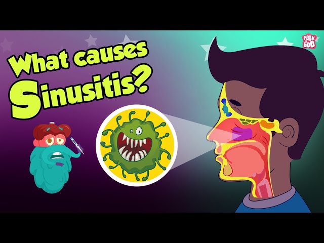 What Causes Sinusitis? | Sinus Infection | Dr Binocs Show | Peekaboo Kidz