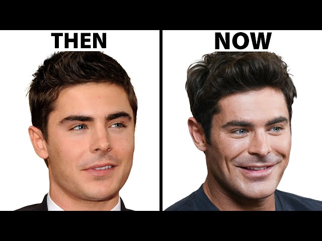 Is Zac Efron's Face All Natural? | Plastic Surgery Analysis
