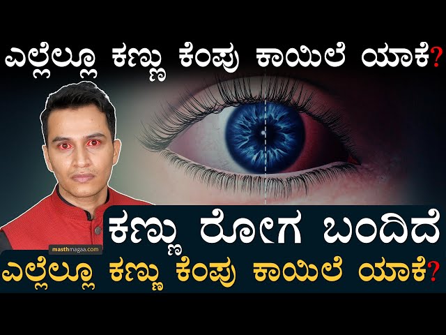 ಕಣ್ಣು ಕೆಂಪಾಗಿಸುತ್ತಿದೆ 'ಮದ್ರಾಸ್‌ ಐ' ಸೋಂಕು! |Conjunctivitis Explained|Madras Eye Infection |MasthMagaa