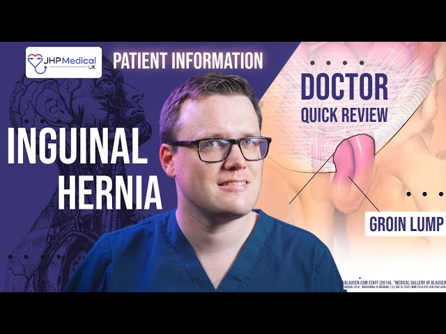 A Doctors Guide to groin (Inguinal) Hernias