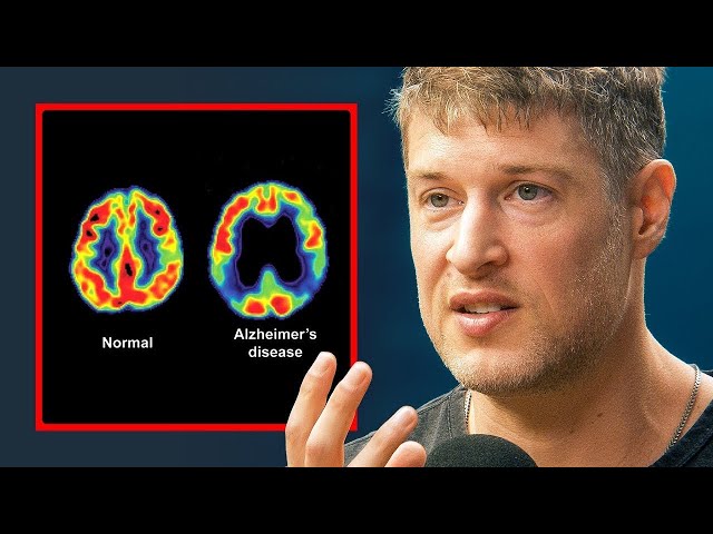 How To Protect Your Brain From Cognitive Decline - Max Lugavere
