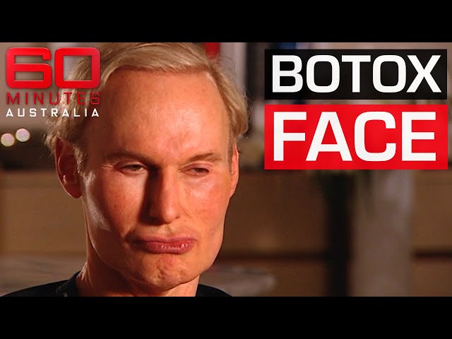 Botox addicts getting younger and younger | 60 Minutes Australia
