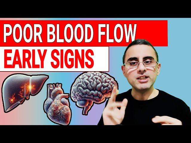6 Signs Your Body's CIRCULATION Is FAILING  - Circulatory Disturbance