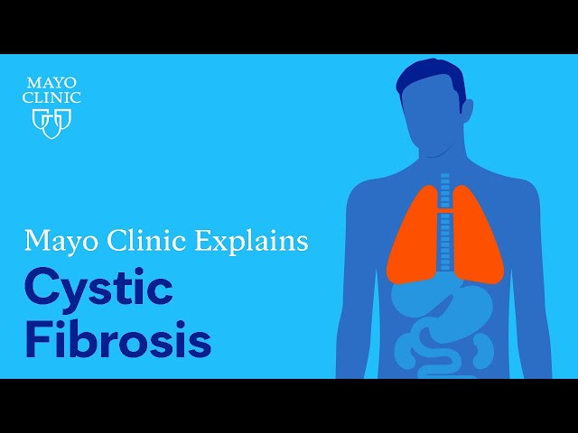 Mayo Clinic Explains Cystic Fibrosis