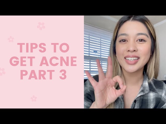 Tips to Get Acne #3 | FaceTory