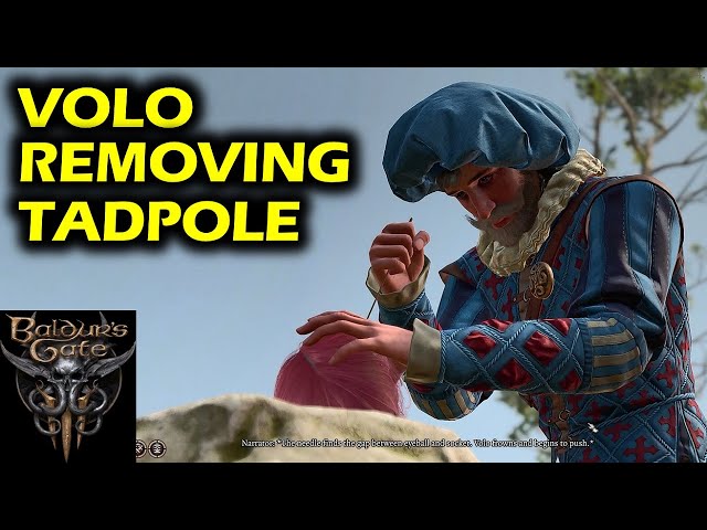 What happens if you allow Volo to remove Illithid Tadpole Parasite | Baldur's Gate 3