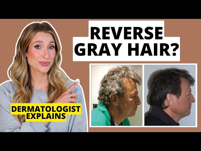 Can You Reverse Gray Hair? Dermatologist Explains | Dr. Sam Ellis