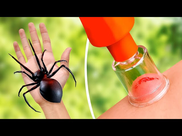 EMERGENCY HACKS AND GADGETS FOR CAMPING || LIFE-SAVING CAMPING HACKS YOU HAVE TO KNOW