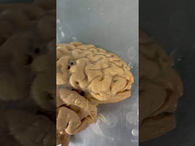 REAL Human Brain & Processing Vision!