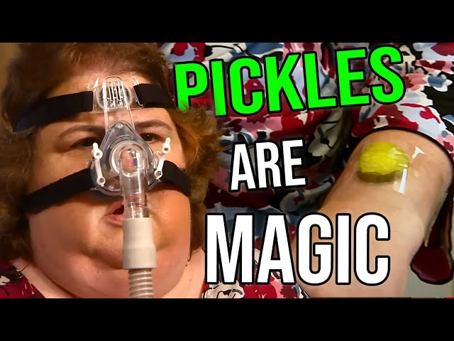 Woman Uses Pickles As Bandaids To Save Money