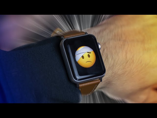 Apple Watch — РАЗВОД ЛОХОВ!