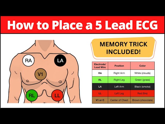 How to Place a 5 Lead ECG: MNEMONIC [Electrode Placement Made Easy] #nursing