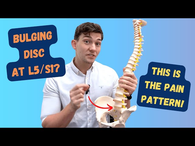 L5-S1 Bulging Disc Pain Pattern Explained!