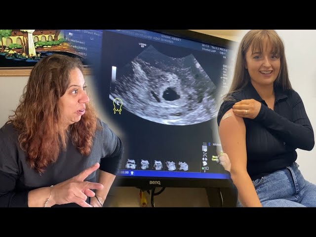 ARE WE HAVING TWINS?! OUR FIRST PREGNANCY ULTRASOUND SCAN *EXCITING*