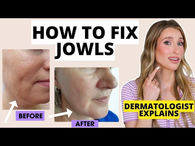 How to Fix Jowls: Dermatologist Explains How to Prevent & Get Rid of Jowls | Dr. Sam Ellis