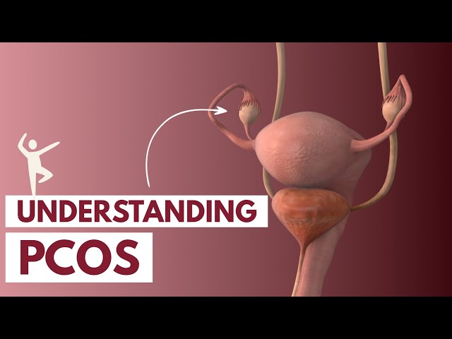 Understanding PCOS | 3D Animation