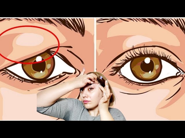 How to Eliminate Eye Puffiness in 5 Minutes