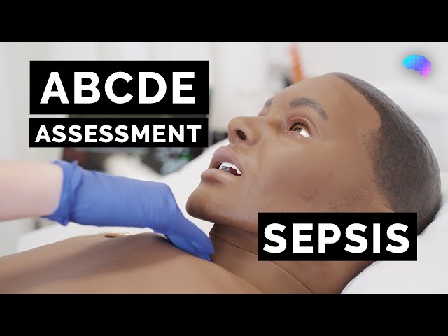 ABCDE Assessment | Sepsis | Emergency Simulation Scenario | OSCE Guide | UKMLA | CPSA