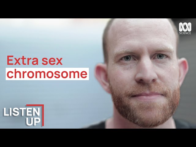 “I Was Born With An Extra Chromosome” | Listen Up | ABC Science