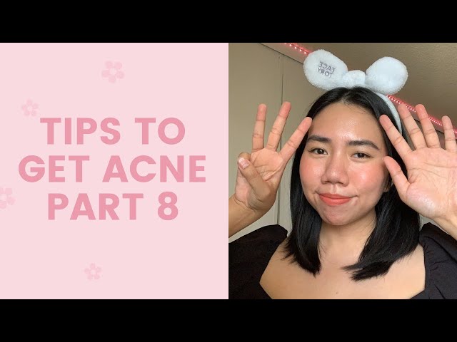 Tips to Get Acne #8 | FaceTory