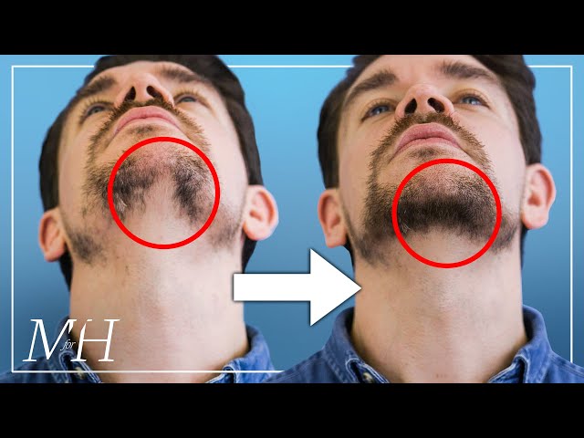 How To Fix Your Patchy Beard… Fast!