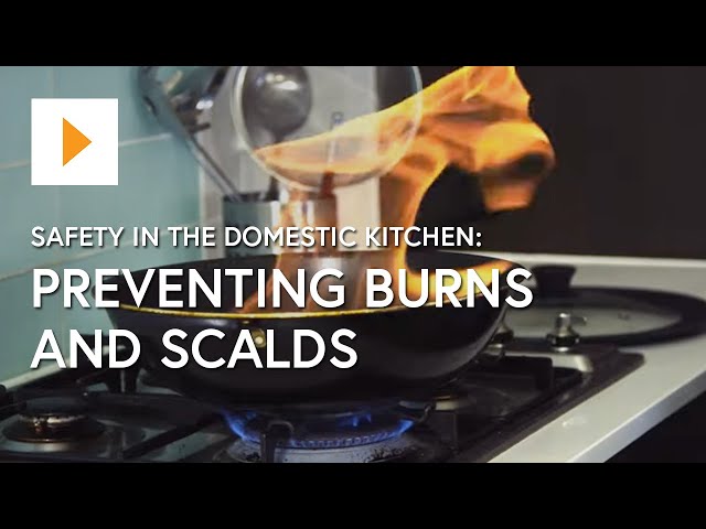 Safety In The Domestic Kitchen: Preventing Burns And Scalds