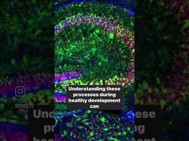 Mouse #brain under microscope #neuroscience #neuropsychology #research #science #shorts #NIH