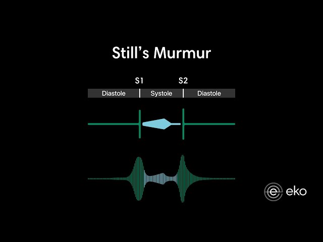 Still's Murmur Recording & Waveform | Eko Health