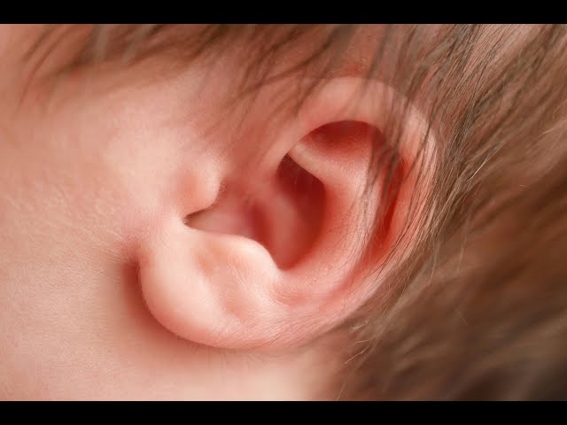 AsktheMayoMom discussing congenital ear anomalies or malformations