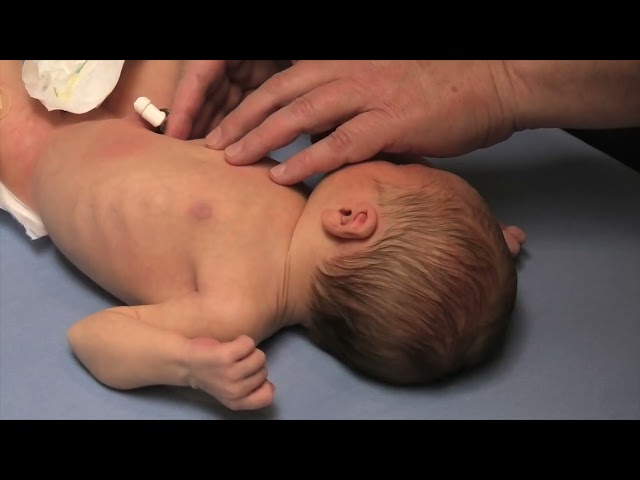 Abdominal Examination of the Newborn - Stanford Medicine