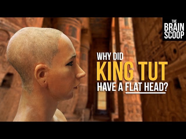 Why did King Tut have a flat head?