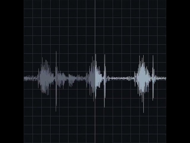 Brachial-radial Pulse Delay Recording & Waveform | Eko Health