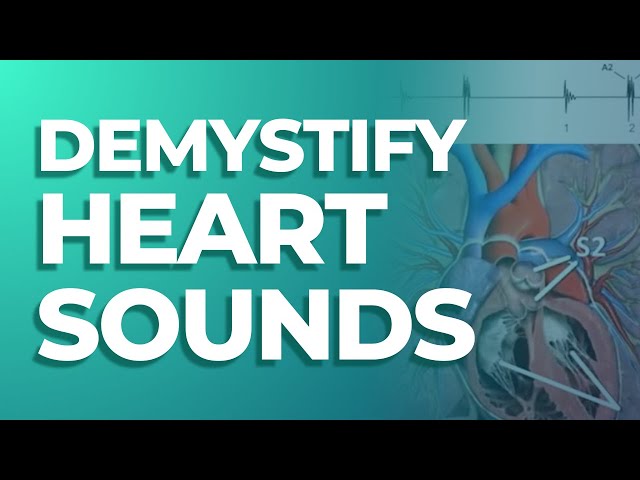 S1, S2, S3, and S4 Heart Sounds | MedStudy's Heart Sounds