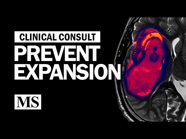 Clinical Consult: Prevent Expansion