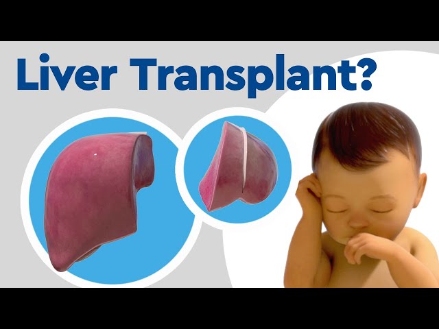 Pediatric Liver Transplant Options