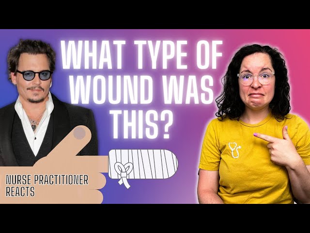 Johnny Depp Finger Injury Explained | Johnny Depp Trial 2022 | Nurse Practitioner Reacts