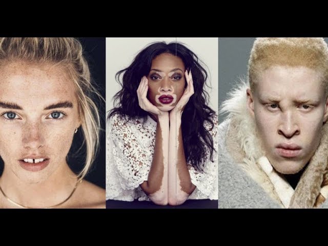 10 Most Unique Models Revolutionizing The Fashion World