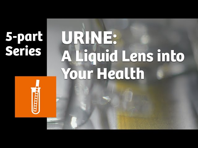 Urine: A liquid lens into your health