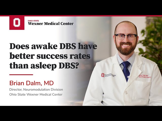 Does awake DBS have better success rates than asleep DBS? | Ohio State Medical Center