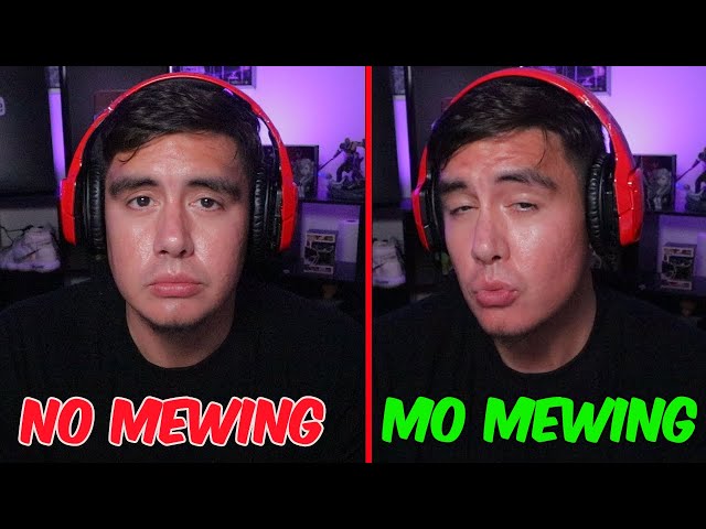 Needs More Mewing