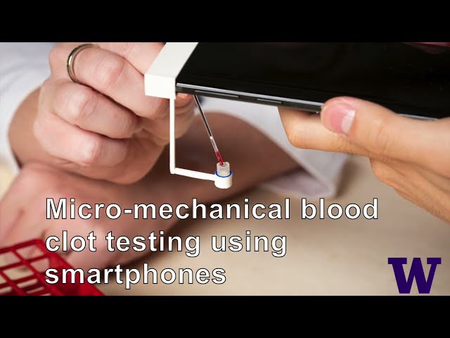 Blood clot testing using smartphones