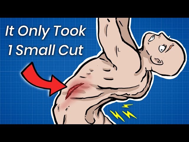 How 1 Small Cut Can Break Your Spine