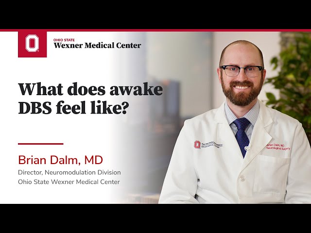 What does awake DBS feel like? | Ohio State Medical Center