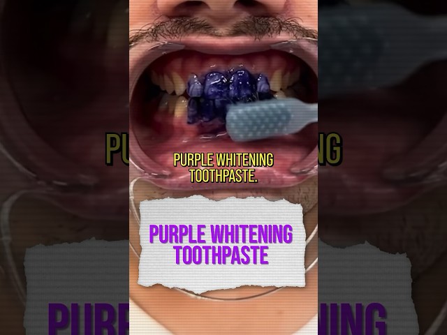 Purple Toothpaste = Whiter Teeth? 😁 #shorts