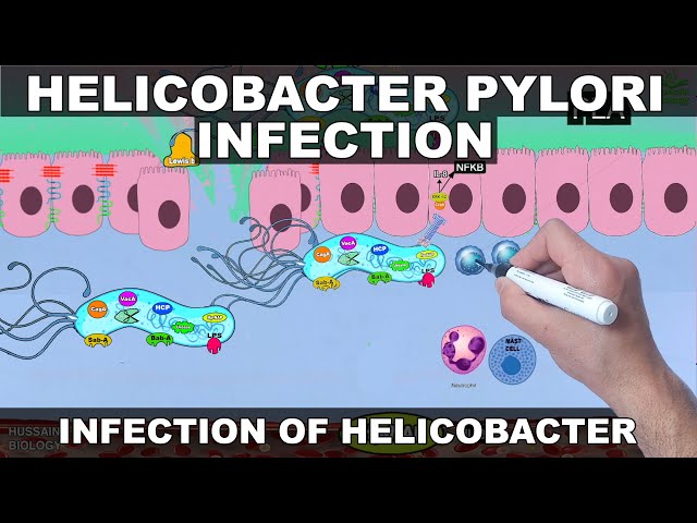 Helicobacter Pylori Pathogenesis | Detailed