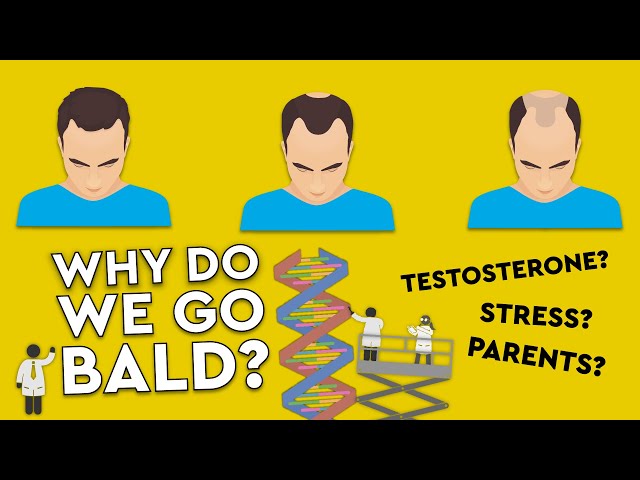 Why Do We Go Bald? / What Causes Hair Loss? #MYTHS #DEBUNKED